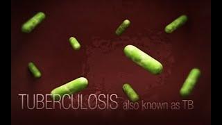 CDC Tuberculosis TB Transmission and Pathogenesis Video