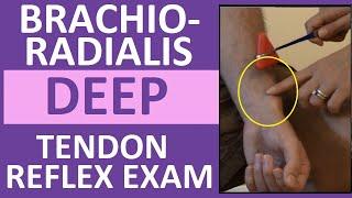 Brachioradialis Deep Tendon Reflex Examination  Nursing Head to Toe Assessment