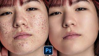 Face Retouching - Best Photoshop Tutorial  Skin Retouching 2023