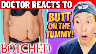 Plastic Surgeon Reacts to BOTCHED A BUTT On Her TUMMY