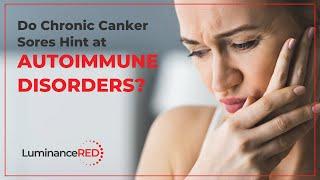 Do Chronic Canker Sores Hint at Autoimmune Conditions?