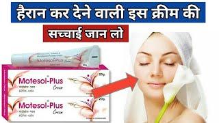 Motesol Plus Cream  motesol plus cream review  use  Motesol Plus Cream Benefits in Hindi