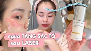 Ngăn tăng sắc tố sau laser  Quin