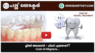 ക്ലിയർ അലൈനർ ചിലവ് എത്രയാണ് ? Cost of Clear Aligner  Video By Dr.Thomas Nechupadam