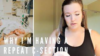 Why Im Having a Repeat C-Section