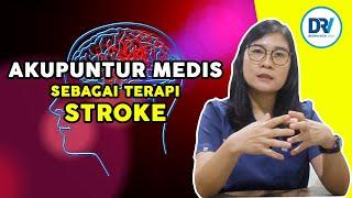 Manfaat Terapi Akupuntur Medis Pada Penyakit Stroke