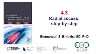 4.3 Radial artery access step-by-step - Manual of PCI