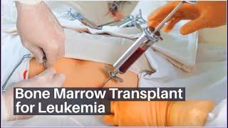 Bone Marrow Transplant for Leukemia  BMT for Blood Cancer  Lyfboat