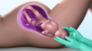 3D Medical Animation - Child Birth Process