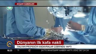 Çinde dünyanın ilk kafa nakli gerçekleştirildi