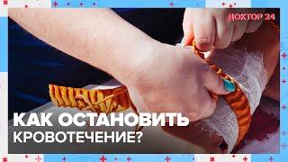 Как остановить КРОВОТЕЧЕНИЕ?  Доктор 24