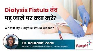 Dialysis Fistula बंद पड़ जाने पर क्या करे?  What if my Dialysis Fistula closes?  Dr Kaurabhi Zade