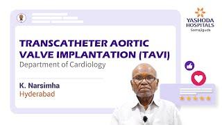 Transcatheter Aortic Valve Implantation TAVI  Severe Aortic Stenosis