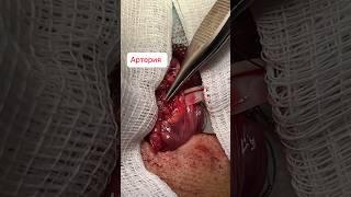 Яичковая артерия