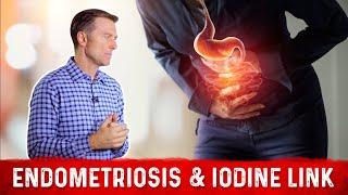 Endometriosis Causes Symptoms & Link With Iodine – Dr. Berg