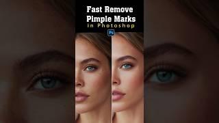fast remove pimple marks Photoshop Short Tutorial  Vidu Art #photoshopt #colorcorrection