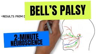 2-Minute Neuroscience Bells Palsy