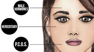 Why Do Women Get Facial Hair?  Expert Advice