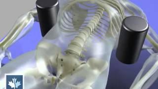 Sciatica  Spinal Decompression  Back Clinics of Canada