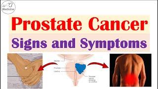 Prostate Cancer Signs and Symptoms Urinary Sexual & Metastatic Symptoms