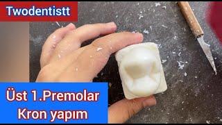 Sabundan Üst 1. Premolar Diş Yapımı  Kron Bölümü  Maxillary First Premolar 