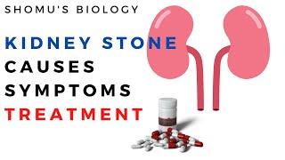 Kidney stones causes symptoms and treatment