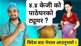 ४.४ के जी को पाठेघरको ट्यूमर ? आमा खुशी हुनुभयो  Episode 61  Nepalese Doctor