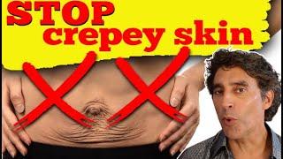 CREPEY SKIN SOLUTIONS  Tighten Loose Skin With These 6 Methods