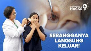 Cara Simple Keluarin Serangga dari Telinga