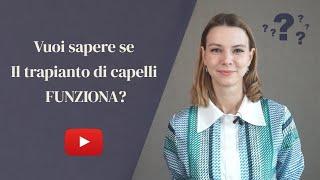 Il trapianto di capelli funziona davvero nel 2023? SPIEGATO IN DETTAGLIO