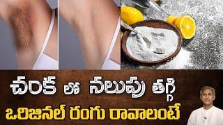 How to Get Rid of Dark Underarms  Remedy to Lighten your Armpits  Dr. Manthenas Beauty Tips