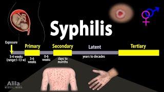 Syphilis - Pathophysiology Diagnosis and Treatments Animation