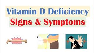 Vitamin D Deficiency Signs & Symptoms ex. Fatigue Diagnosis Treatment