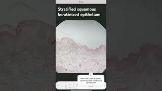 Stratified Squamous Keratinised Epithelium