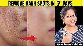 How to Remove Pigmentation Dark Spots Melesma SunTan Naturally Clear Glowing Skin 100% Results