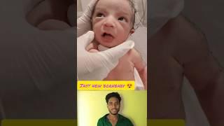 Jast new bornbaby #junior #birth #babycare #cutebaby #cuteshorts #ytsorts #viral