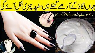 Hands Feet Whitening Formula  ہاتھوں پاؤں کو گورا چٹا کرنے والا طریقہ  Hands Feet Whitening DIY