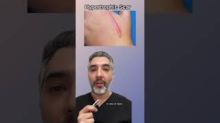 Hypertrophic vs Keloid Scars Whats the Difference and How to Treat Them