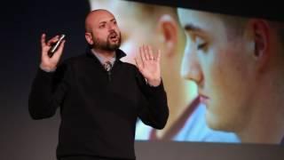 A Different Approach To Pain Management Mindfulness Meditation  Fadel Zeidan  TEDxEmory