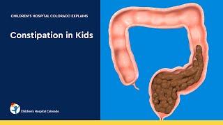 Pediatric Laxatives Senna vs PEG