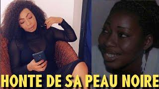 LOLO BEAUTÉ « J’AVAIS HONTE DE MA PEAU NOIRE ET SALE »