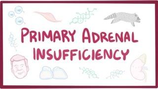 Primary adrenal insufficiency Addisons disease - pathology symptoms diagnosis treatment