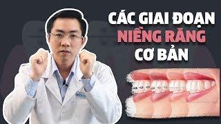 Các Giai Đoạn Niềng Răng Cơ Bản Ai Cũng Cần Biết