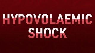 Recognising and Managing Hypovolaemic Shock  Ausmed Lecture