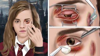 ASMR Removing broken glass from Emma Watsons Eyes  WOW Brain Satisfying video