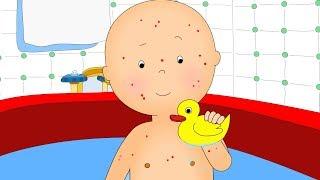 NEW Caillou gets Chicken Pox  Fun for Kids  Videos for Toddlers  Full Episode  Cartoon movie