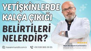 Yetişkinlerde Kalça Çıkığı Belirtileri Nelerdir?  Prof. Dr. Hasan Hilmi Muratlı