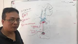 DCMLdorsal column medial lemniscalRhombergs testposterior cord syndromeFriedrichs Ataxia