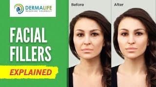 Facial Fillers Frequently Asked Questions  Dermal Fillers Treatment in Delhi