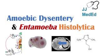 Amebiasis Amoebic Dysentery  Entamoeba histolytica Pathogenesis Signs & Symptoms Treatment